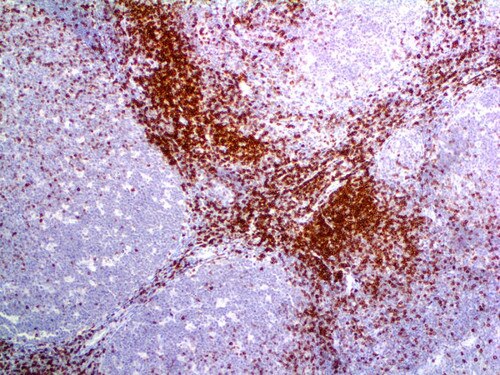 IHC of CD7 Rmab on an FFPE Tonsil Tissue